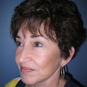 Eyelids, Neck & Facial Surgery