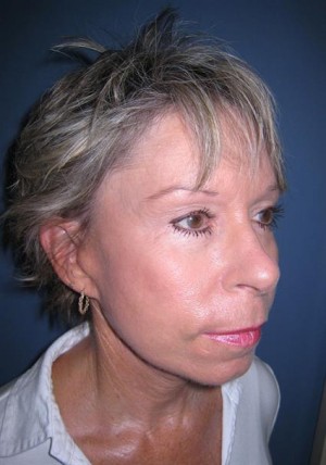 Eyelids, Neck & Facial Surgery
