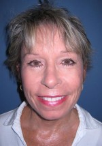 Eyelids, Neck & Facial Surgery