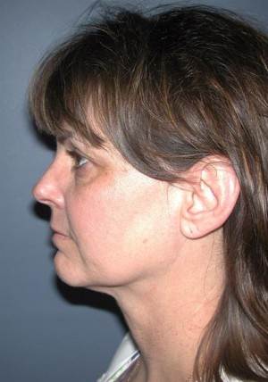 Eyelids, Neck & Facial Surgery