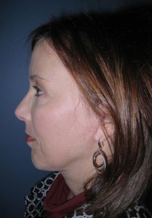 Eyelids, Neck & Facial Surgery