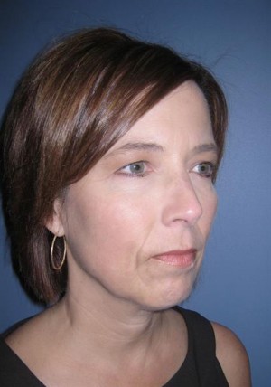 Eyelids, Neck & Facial Surgery