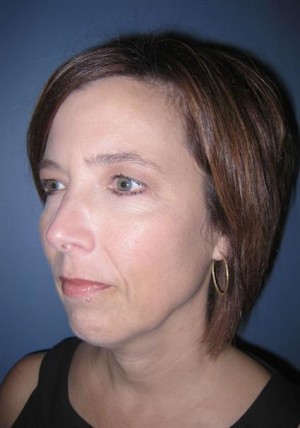 Eyelids, Neck & Facial Surgery