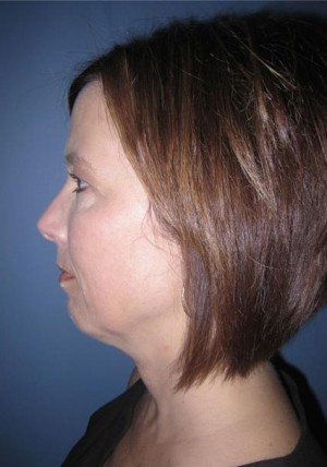 Eyelids, Neck & Facial Surgery